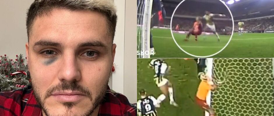 Mauro Icardi fue agredido durante el partido ante Fenerbahce por la Superliga Turca.